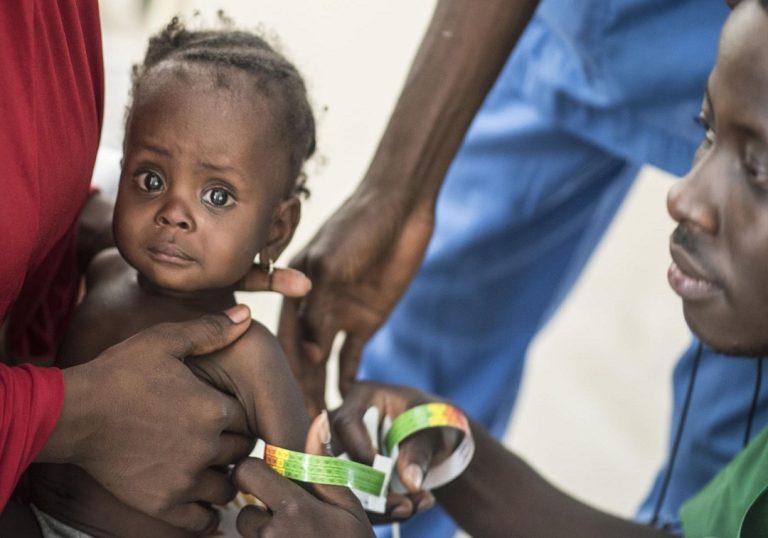 Le nombre d’enfants pris en charge de la malnutrition aiguë au Togo